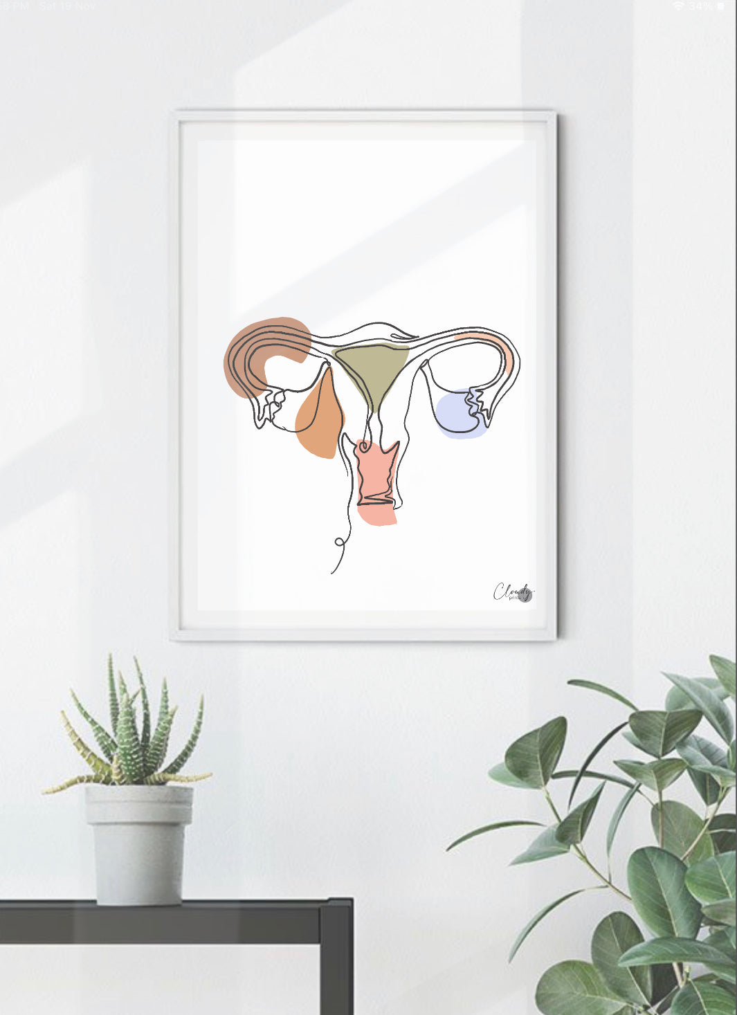 Modern female reproductive system medical illustration displayed in a women’s health clinic